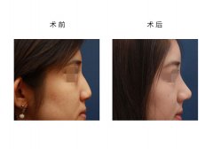 ���м��w¡���m����Щ������