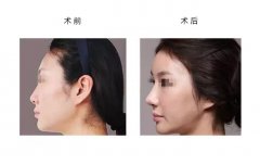 ���м��w¡�ǲ�������x��