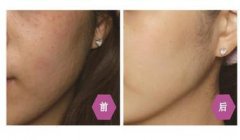 ����ˮ��ᘾS�֕r�g��ˮ������տsë�׆���