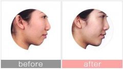 ����ע���S�°̓�(y��u)�ݼ�ע���������Щ��