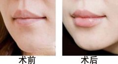 ����ע���S���g(sh��)�Ĳ�������Щ?