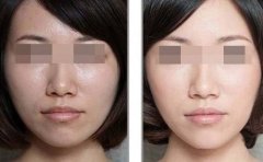 �������������w��ȫ����