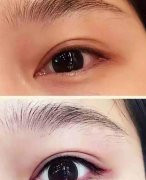 ��������ͫ��Σ������Щ��