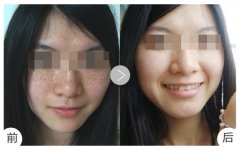 ���м�������F���F��