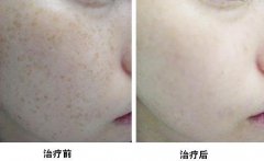 �����c(di��n)ꇼ����Ч���ò��ã�