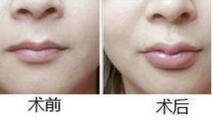 ���в������S����(y��u)��(sh��)�cע�����(xi��ng)����Щ��