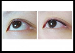 ���мy�۾���ô�ӣ��Æ���