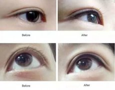 �����nʽ�����üy�۾����֕r�g�����