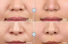 ���з���y���ע����Щ�����