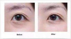 �������w֬�����I�σr���F����