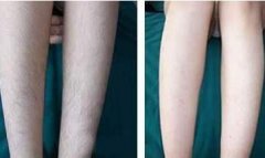 ���м���Óë��(du��)Ƥ�w�Ђ�������