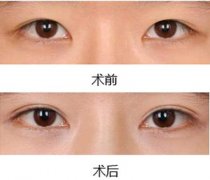 �������������p��Ƥ߀�������p��Ƥ���Ά᣿