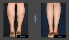 ����С����֬���m��(y��ng)�Y����Щ��