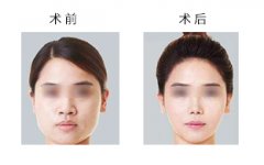 ���д���Ę�ע�����(xi��ng)����Щ��