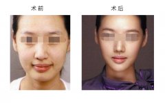 ����ע����Ę�6��ע�����(xi��ng)����Щ��