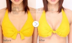 �������w֬��ע��¡��ע�����(xi��ng)����Щ��