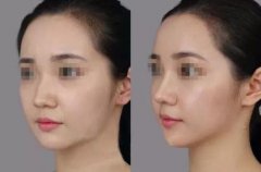 ���м��w¡�ǲ��χ��a(ch��n)���M(j��n)����һ�N����