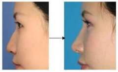 ����¡�ǵĳ��ò����c���g(sh��)��������Щ��