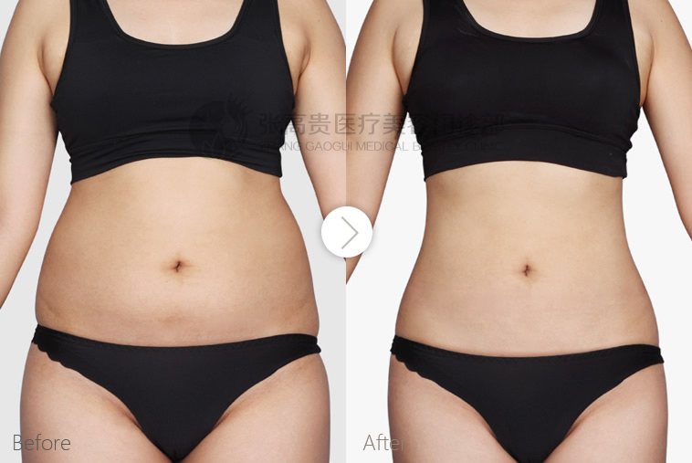 ΢�ňDƬ_20200420093242