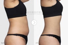 ����������֬��ô����