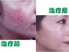 ���м�����tѪ�z��ԭ�����^(gu��)������Щ��