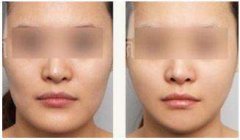 �������N�S���a�ķ�����֪���ǎ׷N��