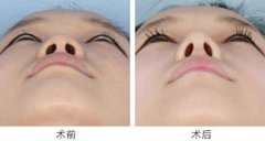 ���б�С�����L���g(sh��)��ȫ����