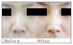 ���б�С�����LЧ�������