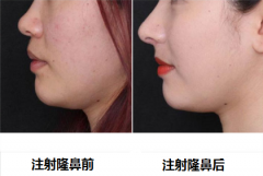 ����ע��¡���ޏ�����Щ������