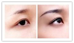 ������ü�g(sh��)Ч����ô����