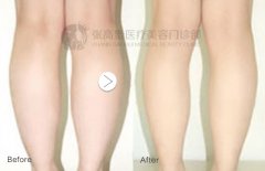 �������С����֬������Ч��?