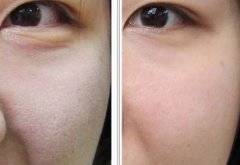 ����ˮ��ע����ô�ӣ�