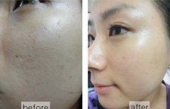 ����ˮ�����w�İ�ȫ����ô����