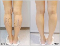 ����С����֬�p���g(sh��)������o(h��)����