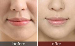 ����ע�䲣����ȥ����yҪ�����X��