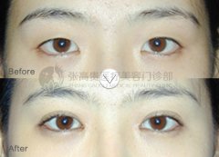 �����_�۽��g(sh��)����к��E�᣿