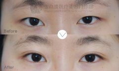 �����ز����g(sh��)����ʲô��Ҫע��Ć���