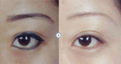 ���м���ϴü��ʲôԭ����