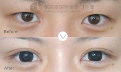 �������_�۽����g(sh��)������Ҫע��Ć᣿