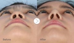 ������η�ֹ¡�����g(sh��)�ĺ��z�Y��