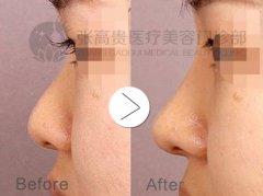 ����¡�ǿ��������沿�����w�І� ��