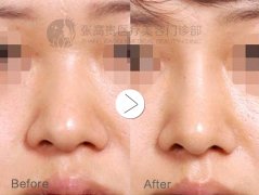 ����¡���g(sh��)�������Ҫ��ôȥ�x������