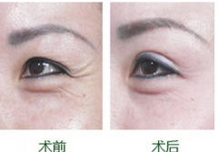 ������ο��Է�ֹ�~β�y�ĳ��F(xi��n)����