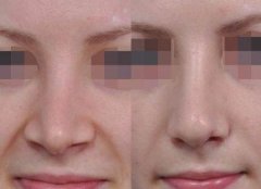 ���б����sС���g(sh��)������Щ��ʽ����