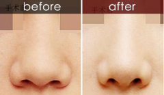 ������������sС���g(sh��)��(y��ng)ԓ��ô̎����