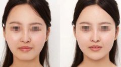 ���в�����ע��¡�°͵ă�(y��u)�c(di��n)��ʲô��