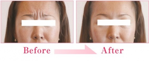 u=53890280,3772129101&fm=26&gp=0