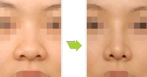 u=454226955,2873649073&fm=26&gp=0