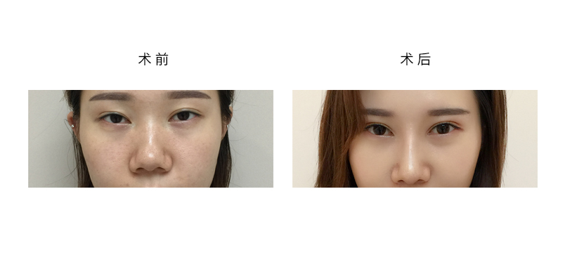 b5e079a64865012aceb77f63afd29ee