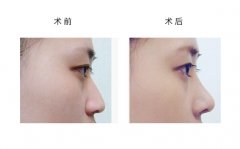 ���ͺ��ر����ʴ���ô�����أ�